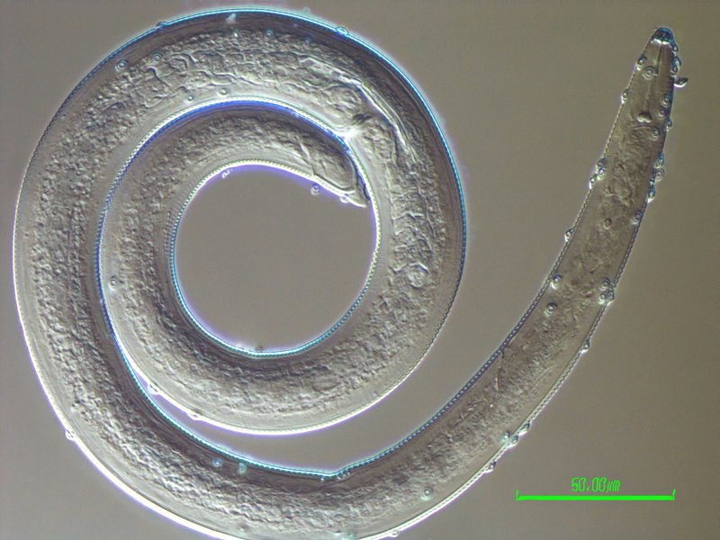 Helicotylenchus with Pasteuria sp4.jpg
