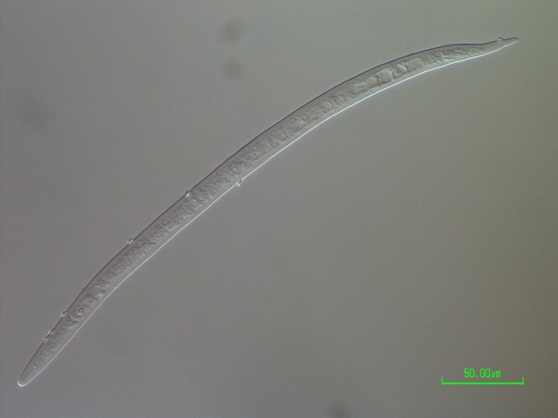 Meloidogyne sp. with Pasteuria infection1.jpg